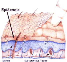 microdermabrasion